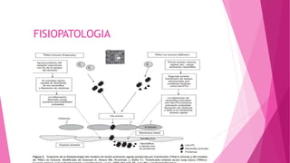 FISIOPATOLOGIA
 