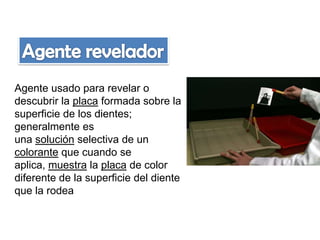 Agente usado para revelar o
descubrir la placa formada sobre la
superficie de los dientes;
generalmente es
una solución selectiva de un
colorante que cuando se
aplica, muestra la placa de color
diferente de la superficie del diente
que la rodea

 