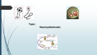 Topic :
Neurocysticercosis:
 