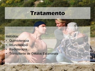 Métodos:  Quimioterapia Imunoterapia Radioterapia Transplante de Células Estaminais Tratamento 