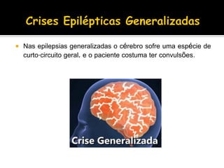  Nas epilepsias generalizadas o cérebro sofre uma espécie de
curto-circuito geral, e o paciente costuma ter convulsões.
 