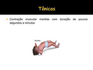  Contração muscular mantida com duração de poucos
segundos a minutos
 