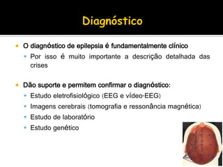  O diagnóstico de epilepsia é fundamentalmente clínico
 Por isso é muito importante a descrição detalhada das
crises
 Dão suporte e permitem confirmar o diagnóstico:
 Estudo eletrofisiológico (EEG e vídeo-EEG)
 Imagens cerebrais (tomografia e ressonância magnética)
 Estudo de laboratório
 Estudo genético
 