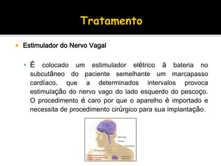  Estimulador do Nervo Vagal
 É colocado um estimulador elétrico à bateria no
subcutâneo do paciente semelhante um marcapasso
cardíaco, que a determinados intervalos provoca
estimulação do nervo vago do lado esquerdo do pescoço.
O procedimento é caro por que o aparelho é importado e
necessita de procedimento cirúrgico para sua implantação.
 