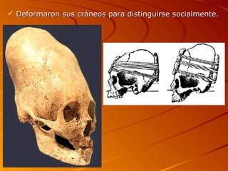  Deformaron sus cráneos para distinguirse socialmente.
 