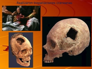 Realizaron trepanaciones craneanas
 