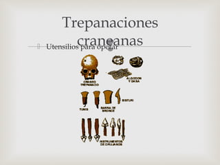  Utensilios para operar
Trepanaciones
craneanas
 