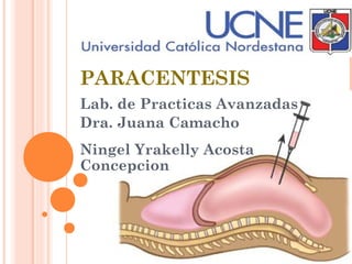 PARACENTESIS
Lab. de Practicas Avanzadas
Dra. Juana Camacho
Ningel Yrakelly Acosta
Concepcion
 
