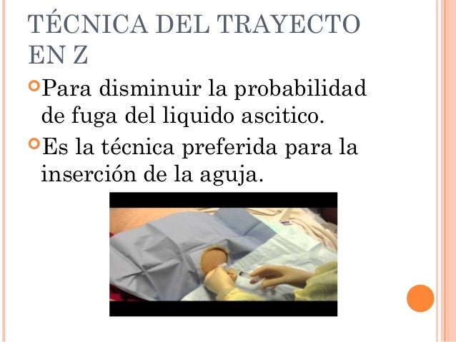 Tecnica De Z Para Inyectar Hierro es.slideshare.net