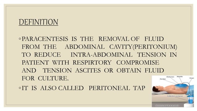 Paracentesis | PPTX