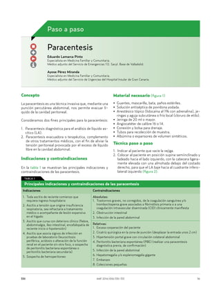 AMF 2014;10(6):330-333	 36330
Concepto
La paracentesis es una técnica invasiva que, mediante una
punción percutánea abdominal, nos permite evacuar lí-
quido de la cavidad peritoneal.
Consideramos dos fines principales para la paracentesis:
1. Paracentesis diagnóstica para el análisis de líquido as-
cítico (LA).
2. Paracentesis evacuadora o terapéutica, complemento
de otros tratamientos médicos, con el fin de aliviar la
tensión peritoneal provocada por el exceso de líquido
libre en la cavidad abdominal.
Indicaciones y contraindicaciones
En la tabla 1 se muestran las principales indicaciones y
contraindicaciones de las paracentesis.
Material necesario (figura 1)
• Guantes, mascarilla, bata, paños estériles.
• Solución antiséptica de povidona yodada.
• Anestésico tópico (lidocaína al 1% con adrenalina), je-
ringas y aguja subcutánea o frío local (cloruro de etilo).
• Jeringa de 20 ml o mayor.
• Angiocatéter de calibre 16 o 14.
• Conexión y bolsa para drenaje.
• Tubos para recolección de muestra.
• Albúmina o expansores de volumen sintéticos.
Técnica paso a paso
1.	Indicar al paciente que vacíe la vejiga.
2.	Colocar al paciente en posición supina semiinclinado y
ladeado hacia el lado izquierdo, con la cabecera ligera-
mente elevada con una almohada debajo del costado
derecho, para que el LA baje hacia al cuadrante infero-
lateral izquierdo (figura 2).
Paracentesis
Eduardo Lamarca Pinto
Especialista en Medicina Familiar y Comunitaria.
Médico adjunto del Servicio de Emergencias 112. Sacyl. Base de Valladolid.
Ayose Pérez Miranda
Especialista en Medicina Familiar y Comunitaria.
Médico adjunto del Servicio de Urgencias del Hospital Insular de Gran Canaria.
Paso a paso
Principales indicaciones y contraindicaciones de las paracentesis
Indicaciones Contraindicaciones
1.	Toda ascitis de reciente comienzo que
requiera ingreso hospitalario
2.	Ascitis a tensión que origine insuficiencia
respiratoria, sea refractaria a tratamiento
médico o acompañante de lesión expansiva
en el hígado
3.	Ascitis que cursa con deterioro clínico (fiebre,
abdominalgia, íleo intestinal, encefalopatía de
reciente inicio o hipotensión)
4.	Ascitis que asocia signos de infección en
pruebas de laboratorio (leucocitosis
periférica, acidosis o alteración de la función
renal en el paciente sin otro foco, o sospecha
de peritonitis bacteriana espontánea o
peritonitis bacteriana secundaria)
5.	Sospecha de hemoperitoneo
Absolutas:
1.	Trastornos graves, no corregidos, de la coagulación sanguínea y/o
trombocitopenia grave asociados a fibrinólisis primaria o a una
coagulación intravascular diseminada (CID) clínicamente manifiesta
2.	Obstrucción intestinal
3.	Infección de la pared abdominal
Relativas:
1.	 Escasa cooperación del paciente
2.	Cicatriz quirúrgica en la zona de punción (desplazar la entrada unos 2 cm)
3.	Hipertensión portal grave con circulación colateral abdominal
4.	Peritonitis bacteriana espontánea (PBE) (realizar una paracentesis
diagnóstica previa, de confirmación)
5.	Infección de la pared abdominal
6.	Hepatomegalia y/o esplenomegalia gigante
7.	 Embarazo
8.	Colecciones pequeñas
TABLA 1
 