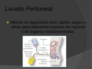 Paracentesis y lavado peritoneal | PPT