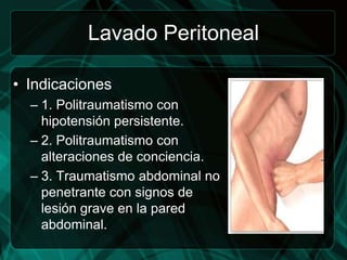 Lavado Peritoneal

• Indicaciones
  – 1. Politraumatismo con
    hipotensión persistente.
  – 2. Politraumatismo con
    alteraciones de conciencia.
  – 3. Traumatismo abdominal no
    penetrante con signos de
    lesión grave en la pared
    abdominal.
 