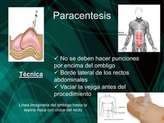Paracentesis



                    No se deben hacer punciones
                   por encima del ombligo
Técnica             Borde lateral de los rectos
                   abdominales
                    Vaciar la vejiga antes del
                   procedimiento
Línea Imaginaria del ombligo hasta la
   espina iliaca con cruce del recto
 