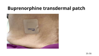 25 /38
25
Buprenorphine transdermal patch
 