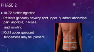 PHASE 2
18-72 h after ingestion
Patients generally develop right upper quadrant abdominal
pain, anorexia, nausea,
and vomiting
Right upper quadrant
tenderness may be present
15
 