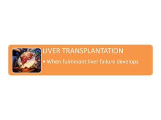LIVER TRANSPLANTATION
• When fulminant liver failure develops