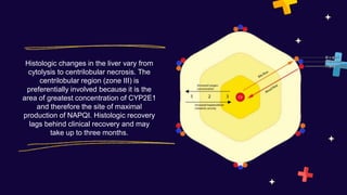 Histologic changes in the liver vary from
cytolysis to centrilobular necrosis. The
centrilobular region (zone III) is
preferentially involved because it is the
area of greatest concentration of CYP2E1
and therefore the site of maximal
production of NAPQI. Histologic recovery
lags behind clinical recovery and may
take up to three months.
 