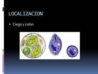LOCALIZACION
 Ciego y colon
 