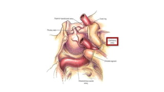Paraclinoid aneurysms | PPTX