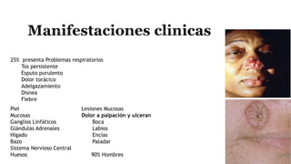 25% presenta Problemas respiratorios
Tos persistente
Esputo purulento
Dolor torácico
Adelgazamiento
Disnea
Fiebre
Piel
Mucosas
Ganglios Linfáticos
Glándulas Adrenales
Hígado
Bazo
Sistema Nervioso Central
Huesos
Lesiones Mucosas
Dolor a palpación y ulceran
Boca
Labios
Encías
Paladar
90% Hombres
 