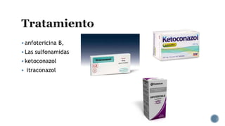  anfotericina B,
 Las sulfonamidas
 ketoconazol
 itraconazol
 