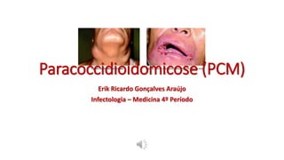 Paracoccidioidomicose (PCM)
Erik Ricardo Gonçalves Araújo
Infectologia – Medicina 4º Período
 