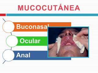 MUCOCUTÁNEA
Buconasal
Ocular
Anal
 