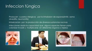 Infeccion fúngica
Producen cuadros Alergicos por la inhalasion de esporas(rinitis asma
alveolitis, neumonitis)
Intoxicacion por la producción de diversas sustancias nocivas
Infecciones dada la capacidad que alguno especies tienen para
colonizar invadir y multiplicarse en diferentes órganos o tejidos
 