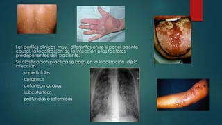 Los perfiles clínicos muy diferentes entre si por el agente
causal, la localización de la infección o los factores
predisponentes del paciente.
Su clasificación practica se basa en la localización de la
infección
superficiales
cutáneas
cutaneomucosas
subcutáneas
profundas o sistemicas
 