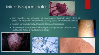 Micosis superficiales
 Son aquellas que se limitan al estado queratinizado de la piel o el
pelo. Sin reacción inflamatoria y muy poca envidencia clínica
 Suelen ser levaduras lipófilas del Genero Malassezia
 Al colonizar la epidermis dan lugar a la aparición de maculas
cutáneas hiper o hipopigmentadas
 