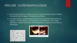 Micosis cutáneomucosas
 Son las que afectan la piel y a las mucosas pueden abarcar tejido
mas profundo sin llegar al tejido subcutáneo.
 Las infecciones superficiales de la mucosa oral Generalmente se
asosian a tratamientos prolongados a antibióticos de amplio
espectro, protesis dentales inmunodeficiencia ligeras o factores no
presisados
 