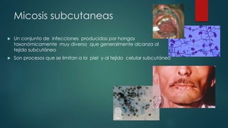 Micosis subcutaneas
 Un conjunto de infecciones producidas por hongos
taxonómicamente muy diverso que generalmente alcanza al
tejido subcutáneo
 Son procesos que se limitan a la piel y al tejido celular subcutáneo
 