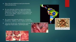  Esta micosis sistémica exclusivamente
latinoamericana.
 Es una micosis crónica, granulomatosa,
pulmonar primaria y las diseminaciones
sistémicas mas frecuentes se localizan en
la mucosa ORAL, nasal y conjuntiva así
como en piel.
 En casos mas graves abarca a nódulos
linfáticos, videras y otros tejidos profundos.
 es una micosis de predominio rural en
regiones tropicales y semitropicales.
 