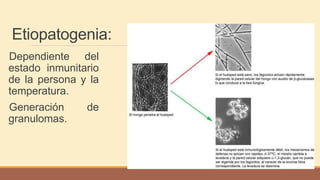 Etiopatogenia:
Dependiente del
estado inmunitario
de la persona y la
temperatura.
Generación de
granulomas.
 