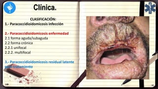 Clínica.
CLASIFICACIÓN:
1.- Paracoccidioidomicosis infección
2.- Paracoccidioidomicosis enfermedad
2.1 forma aguda/subaguda
2.2 forma crónica
2.2.1 unifocal
2.2.2. multifocal
3.- Paracoccidioidomicosis residual latente
post-tratamiento
 