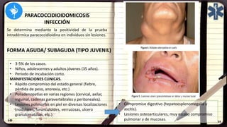 PARACOCCIDIOIDOMICOSIS
INFECCIÓN
Se determina mediante la positividad de la prueba
intradérmica paracoccidioidina en individuos sin lesiones.
FORMA AGUDA/ SUBAGUDA (TIPO JUVENIL)
• 3-5% de los casos.
• Niños, adolescentes y adultos jóvenes (35 años).
• Periodo de incubación corto.
MANIFESTACIONES CLINICAS.
• Rápido compromiso del estado general (fiebre,
pérdida de peso, anorexia, etc.)
• Poliadenopatías en varias regiones (cervical, axilar,
inguinal, cadenas paravertebrales y peritoneales).
• Lesiones polimorfas en piel en diversas localizaciones
(nodulares, forunculoides, verrucosas, ulcero
granulomatosas, etc.)
• Compromiso digestivo (hepatoesplenomegalia y
ascitis).
• Lesiones osteoarticulares, muy escaso compromiso
pulmonar y de mucosas.
 