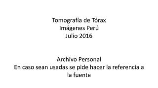 Tomografía de Tórax
Imágenes Perú
Julio 2016
Archivo Personal
En caso sean usadas se pide hacer la referencia a
la fuente
 