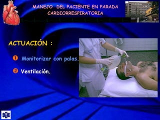 MANEJO DEL PACIENTE EN PARADA
CARDIORRESPIRATORIA
 Ventilación.
ACTUACIÓN :
 Monitorizar con palas.
 