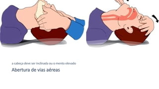 Abertura de vias aéreas
a cabeça deve ser inclinada ou o mento elevado
 