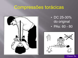 Compressões torácicas
• DC 25-30%
do original
• PAs: 60 - 80
Classe IIa
 