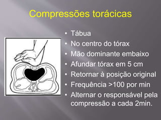 Compressões torácicas
• Tábua
• No centro do tórax
• Mão dominante embaixo
• Afundar tórax em 5 cm
• Retornar à posição original
• Frequência >100 por min
• Alternar o responsável pela
compressão a cada 2min.
 