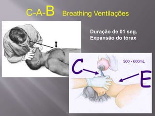 C-A-B Breathing Ventilações
C
E
500 - 600mL
Duração de 01 seg.
Expansão do tórax
 