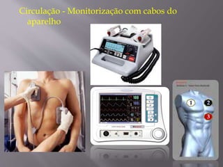 Circulação - Monitorização com cabos do
aparelho
21
3
 