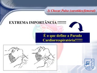 3) Checar Pulso (carotídeo/femoral)


EXTREMA IMPORTÂNCIA !!!!!!!


               É o que define a Parada
               Cardiorrespiratória!!!!!!
 