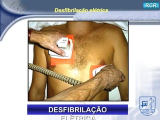 RCR
 Desfibrilação elétrica




DESFIBRILAÇÃO
 