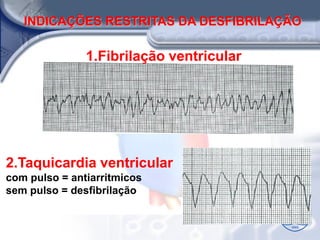 INDICAÇÕES RESTRITAS DA DESFIBRILAÇÃO

               1.Fibrilação ventricular




2.Taquicardia ventricular
com pulso = antiarritmicos
sem pulso = desfibrilação
 