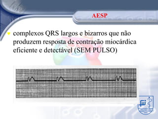AESP

♥   complexos QRS largos e bizarros que não
    produzem resposta de contração miocárdica
    eficiente e detectável (SEM PULSO)
 