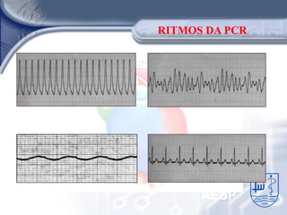 RITMOS DA PCR




      AESP
 