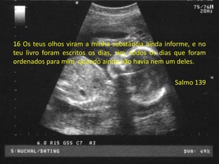 16 Os teus olhos viram a minha substância ainda informe, e no
teu livro foram escritos os dias, sim, todos os dias que foram
ordenados para mim, quando ainda não havia nem um deles.
Salmo 139
 